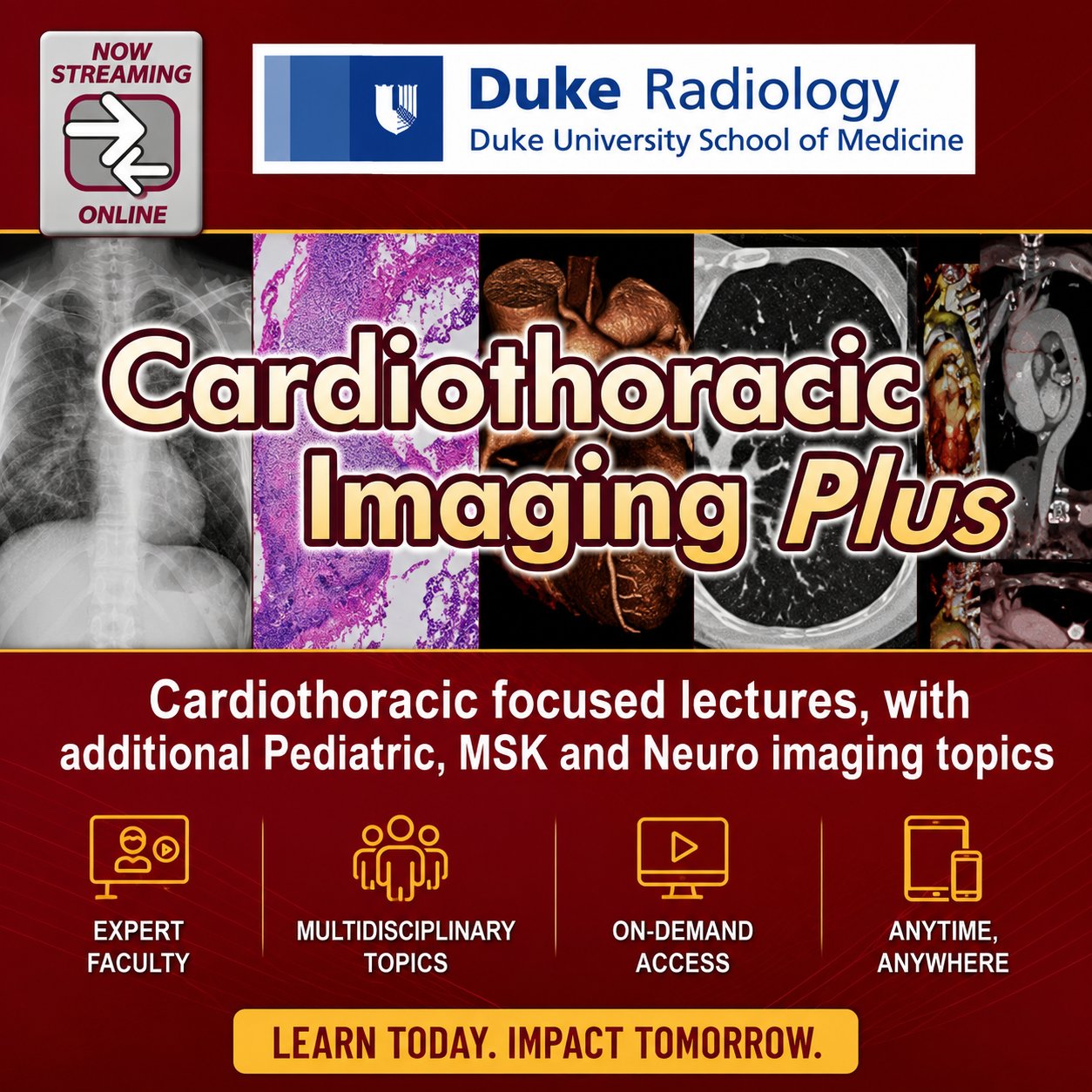 Duke Radiology Cardiothoracic Imaging Plus 2016 Duke Radiology Cardiothoracic Imaging Plus 2016
