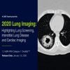 2020 Lung Imaging Highlighting Lung Cancer Screening and Interstitial Lung Disease 2020 Lung Imaging Highlighting Lung Cancer Screening and Interstitial Lung Disease