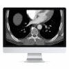Clinical Cardiopulmonary Imaging Review 2019 (ARRS VIDEOS) Clinical Cardiopulmonary Imaging Review 2019 (ARRS VIDEOS)