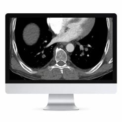 Clinical Cardiopulmonary Imaging Review 2019 (ARRS VIDEOS)