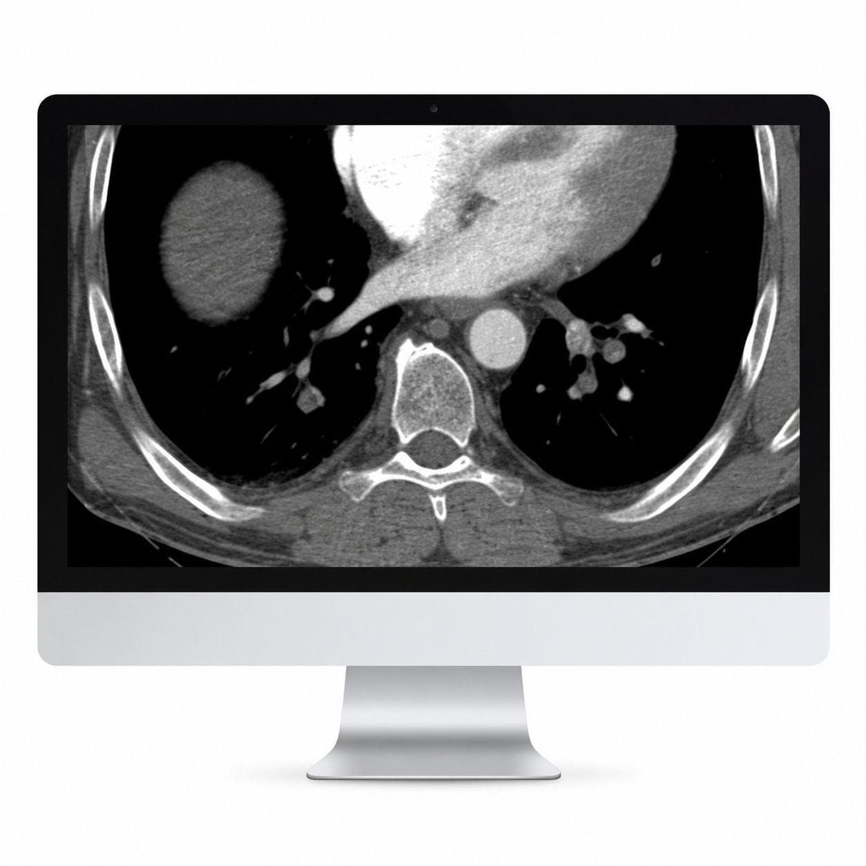 Clinical Cardiopulmonary Imaging Review 2019 (ARRS VIDEOS) Clinical Cardiopulmonary Imaging Review 2019 (ARRS VIDEOS)
