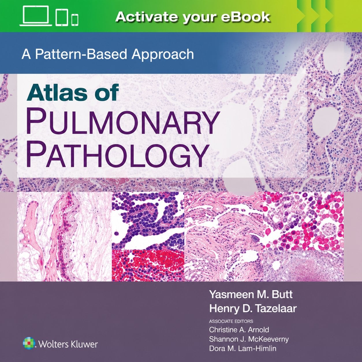 Atlas of Pulmonary Pathology Atlas of Pulmonary Pathology