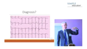 Simple Education : Essential Guide to electrocardiogram (ECG) interpretation (Videos)
