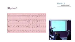Simple Education : Essential Guide to electrocardiogram (ECG) interpretation (Videos) Simple Education : Essential Guide to electrocardiogram (ECG) interpretation (Videos)