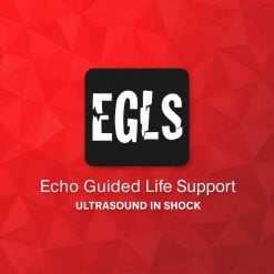 ECHO-Guided Life Support Using ultrasound to categorise shock and guide initial management