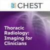 Thoracic Radiology: Imaging for Clinicians (Chestnet) 2021 (Videos + Quiz) Thoracic Radiology: Imaging for Clinicians (Chestnet) 2021 (Videos + Quiz)