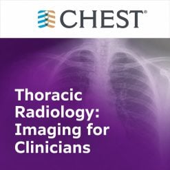 Thoracic Radiology: Imaging for Clinicians (Chestnet) 2021 (Videos + Quiz)