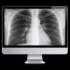 ARRS Case-Based Imaging Review Online Course 2022 ARRS Case-Based Imaging Review Online Course 2022