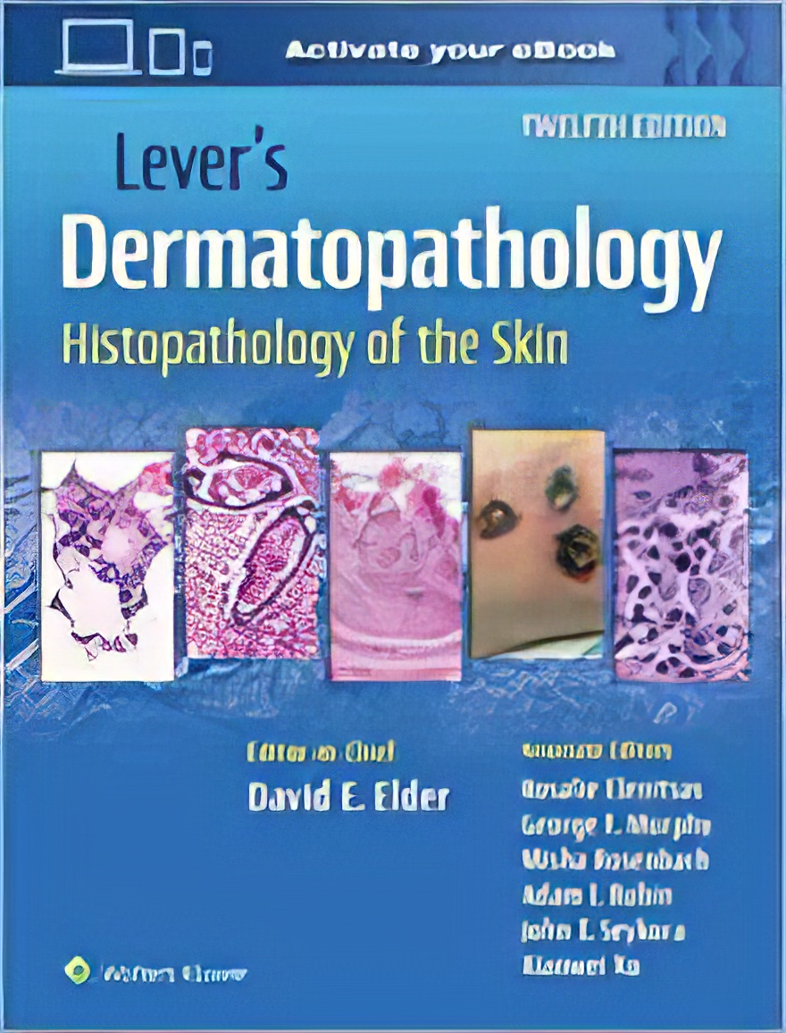 Lever’s Dermatopathology: Histopathology of the Skin, 12th Edition (EPUB3) Lever’s Dermatopathology: Histopathology of the Skin, 12th Edition (EPUB3)