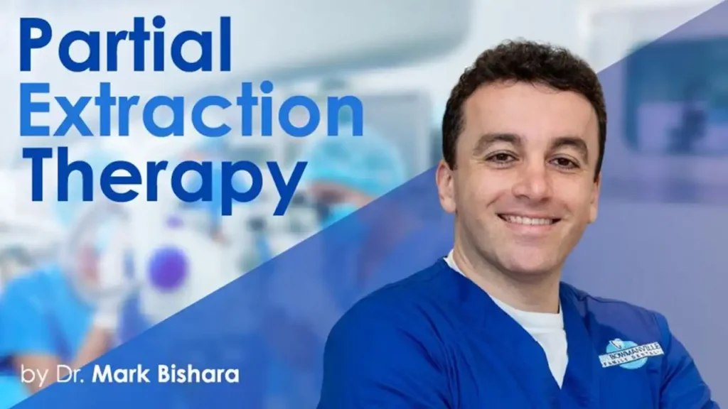 Partial Extraction Therapy Course Partial Extraction Therapy