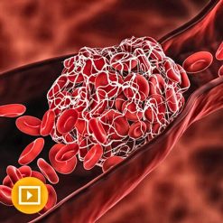 Thrombosis & Thromboembolism 2022