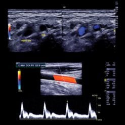 Clinical Approach to Vascular Ultrasound and RPVI Prep Course 2023