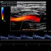 Oakstone Society for Vascular Medicine Comprehensive Review of Vascular Ultrasound Interpretation and Registry Preparation 2023 Oakstone Society for Vascular Medicine Comprehensive Review of Vascular Ultrasound Interpretation and Registry Preparation 2023