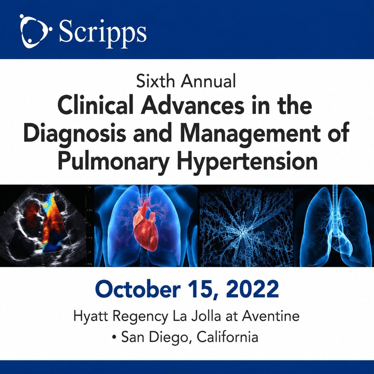 Scripps 6th Annual Clinical Advances in the Diagnosis and Management of Pulmonary Hypertension 2022 Scripps 6th Annual Clinical Advances in the Diagnosis and Management of Pulmonary Hypertension 2022