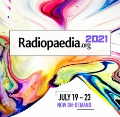 Radiopedia 2021 (July 19 – 23) (Videos, Well Organized)