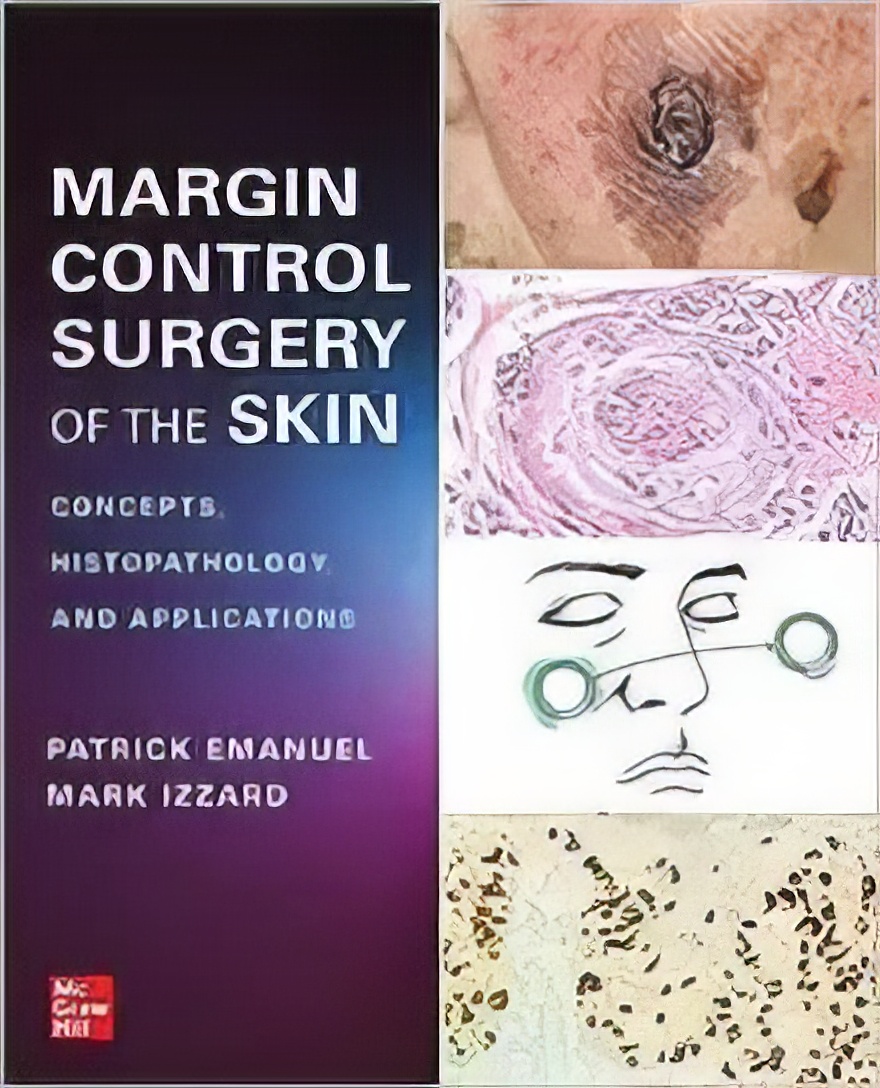 Margin Control Surgery Of The Skin: Concepts, Histopathology, And Applications (Original PDF From Publisher) Margin Control Surgery Of The Skin: Concepts, Histopathology, And Applications (Original PDF From Publisher)