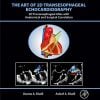 The Art Of 2D Transesophageal Echocardiography (PDF Book+ Videos )