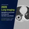 ARRS Lung Cancer Screening A Comprehensive Guide Online Course ARRS Lung Cancer Screening A Comprehensive Guide Online Course