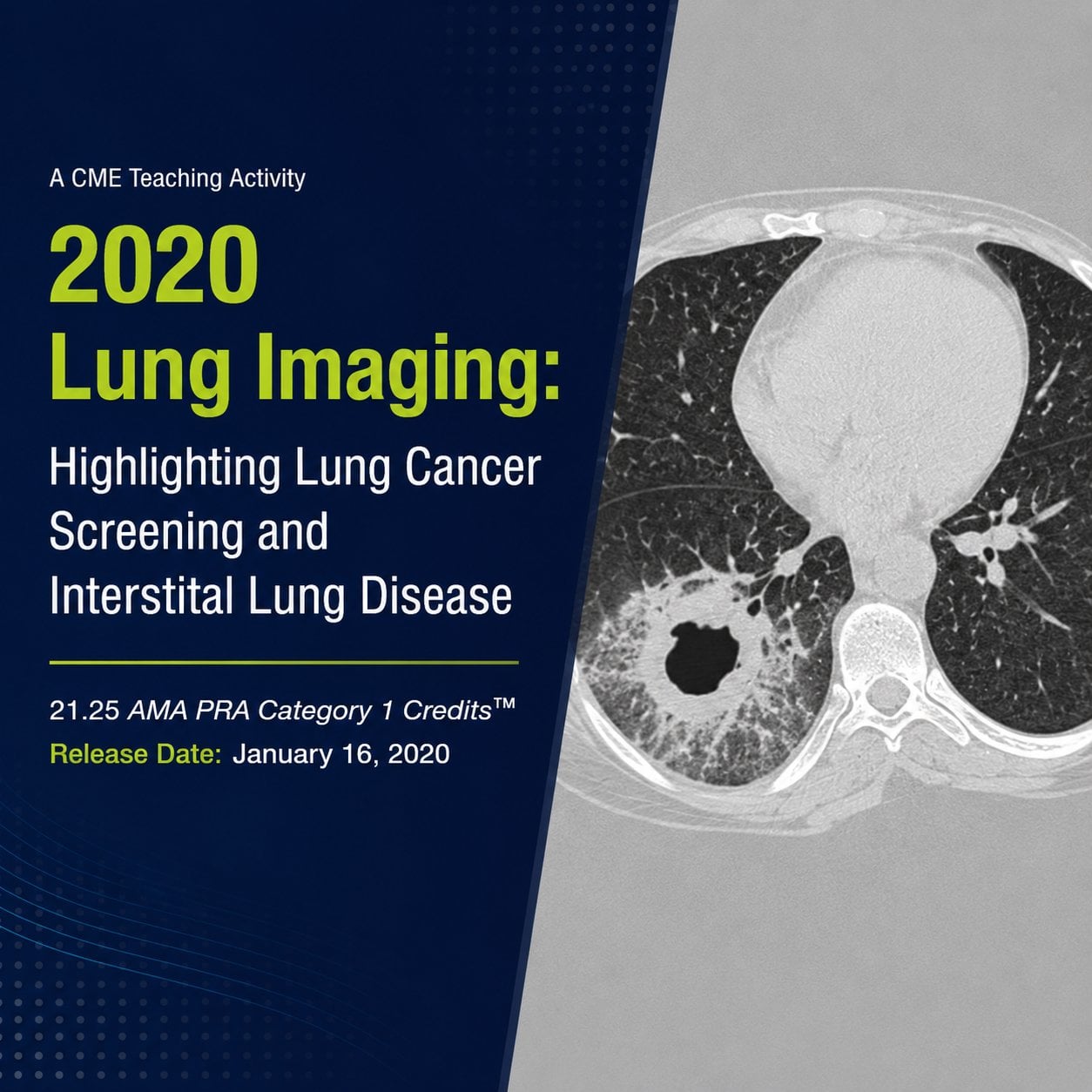 ARRS Lung Cancer Screening A Comprehensive Guide Online Course ARRS Lung Cancer Screening A Comprehensive Guide Online Course