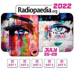 Radiopedia 2022 – Virtual Conference (Videos)