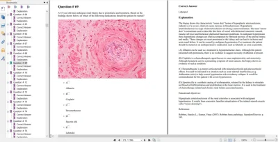 SmashUSMLE Step 1 2021 Complete Qbank, Block-wise version (PDF) SmashUSMLE Step 1 2021 Complete Qbank, Block-wise version (PDF)