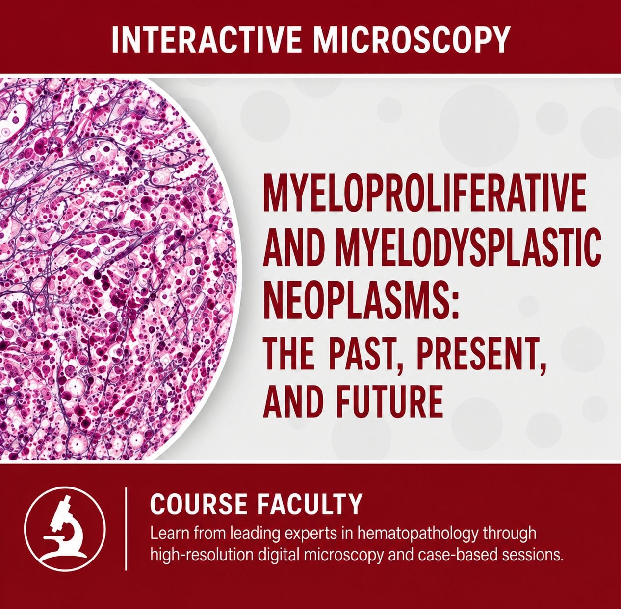 USCAP Myeloproliferative and Myelodysplastic Neoplasms: The Past, Present, and Future 2024 USCAP Myeloproliferative and Myelodysplastic Neoplasms The Past, Present, and Future 2024