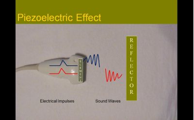 Sonographic Principles and Instrumentation: A Comprehensive Review