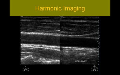 Sonographic Principles and Instrumentation: A Comprehensive Review
