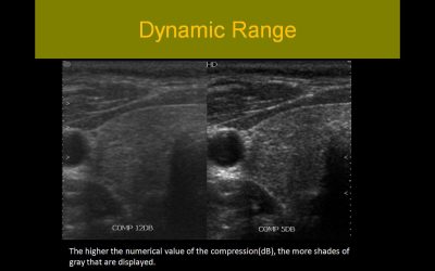 Sonographic Principles and Instrumentation: A Comprehensive Review