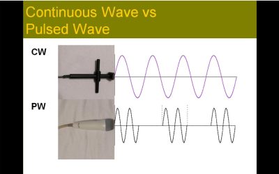 Sonographic Principles and Instrumentation: A Comprehensive Review