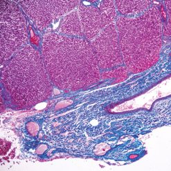 531 current topics in gastrointestinal and liver pathology cme 25052 2