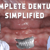 Complete Dentures Simplified Complete Dentures Simplified