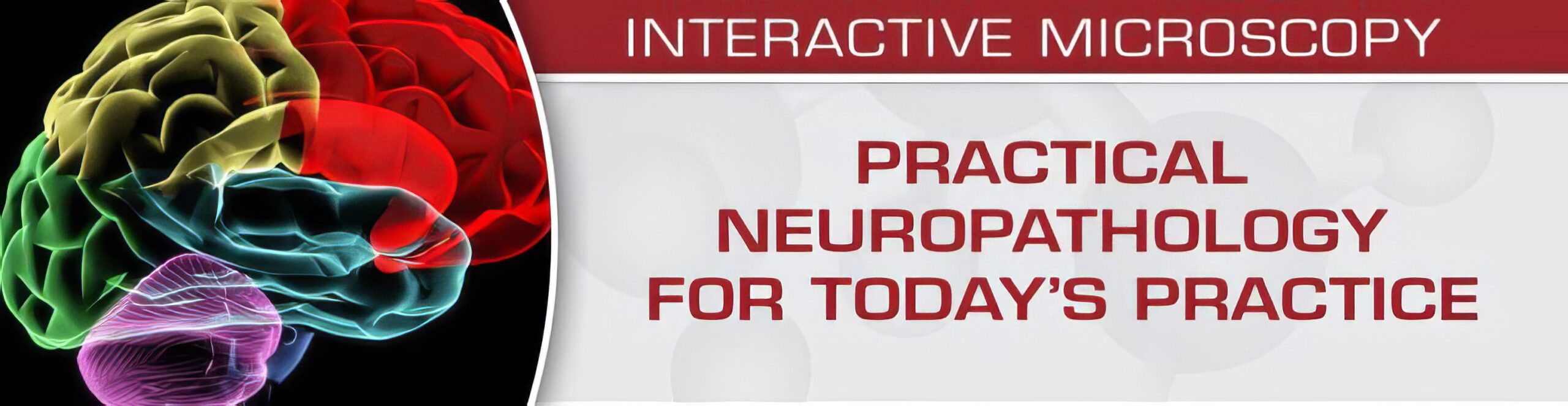 USCAP Practical Neuropathology for Today’s Practice – Interactive Microscopy 2019 USCAP Practical Neuropathology for Today’s Practice – Interactive Microscopy 2019