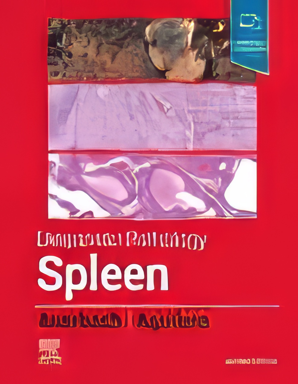 Diagnostic Pathology: Spleen, 2nd Edition (Original PDF from Publisher) Diagnostic Pathology: Spleen, 2nd Edition (Original PDF from Publisher)