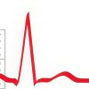 ECGAcademy: Basic To Advanced Theory + Chalktalk (Up To December 2016)