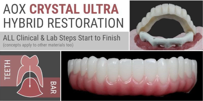 AOX Crystal Ultra Hybrid Restoration: All Clinical & Lab Steps Start to Finish AOX Crystal Ultra Hybrid Restoration: All Clinical & Lab Steps Start to Finish
