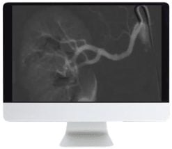 ARRS Case Based Subspecialty Review 2021 CME VIDEOS