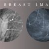 Advanced Breast Imaging 2024 – CMEScience (Videos) Advanced Breast Imaging 2024