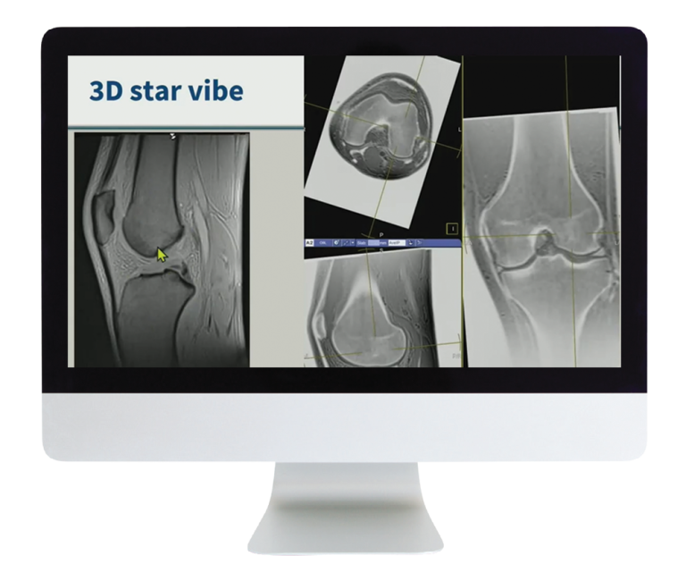 American Roentgen Ray Society 3D MR Imaging of Joints with Arthroscopy Correlations 2023 American Roentgen Ray Society 3D MR Imaging of Joints with Arthroscopy Correlations 2023