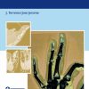 An Evidence-Based Approach To The Fingertip Diseases (Original PDF From Publisher) An Evidence Based Approach To The Fingertip Diseases