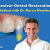 Bioclear Dental Restoration Bioclear Dental Restoration