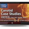 Gulfcoast Carotid Case Studies (Videos+PDFs) Gulfcoast Carotid Case Studies VideosPDFs