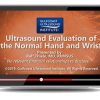 Gulfcoast: Ultrasound Evaluation of the Hand and Wrist Gulfcoast: Ultrasound Evaluation of the Hand and Wrist