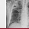 Harvard Infectious Diseases in Adults 2024 Harvard Infectious Diseases in Adults 2024