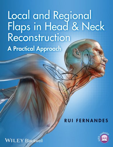 Local And Regional Flaps In Head And Neck Reconstruction: A Practical Approach (Videos+PPT) Local And Regional Flaps In Head And Neck Reconstruction A Practical Approach VideosPPT