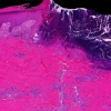 Mayo Clinic Wound Symposium: The Edges Of Wound Care 2023 (Videos+Assessment Quiz) Mayo Clinic Wound Symposium