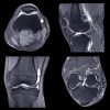 NYU Langone Advanced Imaging of the Musculoskeletal System Up Your Game 2023 NYU Langone Advanced Imaging of the Musculoskeletal System Up Your Game 2023