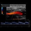 Oakstone Society for Vascular Medicine Comprehensive Review of Vascular Ultrasound Interpretation and Registry Preparation 2023 Oakstone Society for Vascular Medicine Comprehensive Review of Vascular Ultrasound Interpretation and Registry Preparation 2023