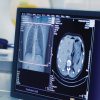 University of Washington Emergency Radiology Review 2023 Oakstone University of Washington Emergency Radiology Review 2023