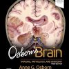 Osborn’s Brain: Imaging,Pathology and Anatomy 3e 2024 Original PDF Osborns Brain ImagingPathology and Anatomy 3e 2024 Original PDF
